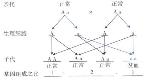 AaAa子代AAaa正常正常贫血正常1基因组成之比