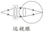 远视眼