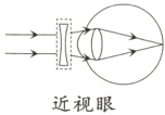 近视眼