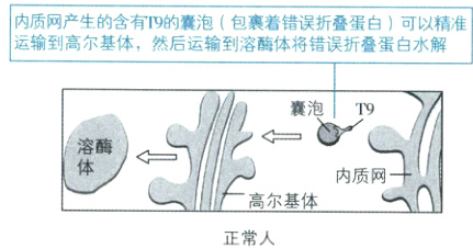 内质网高尔基体正常人