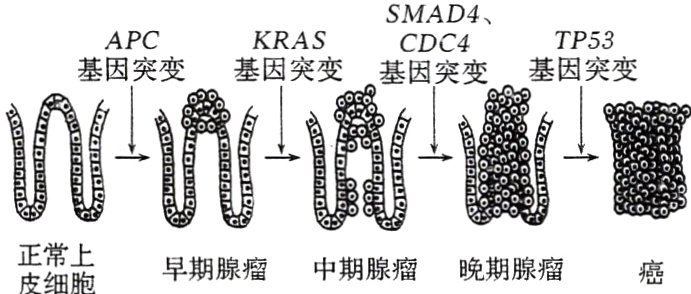 正上早期腺瘤中期腺瘤晚期腺瘤