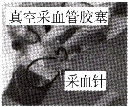 采血针