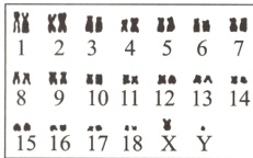 A89101112131415161718Y