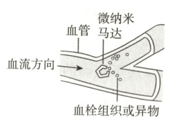 血栓组织或异物