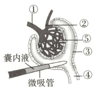囊内液+④微吸管