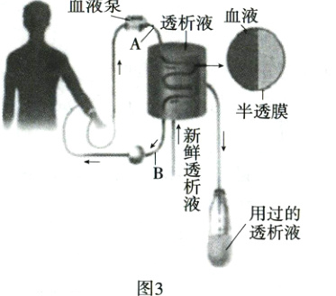 透析液图3