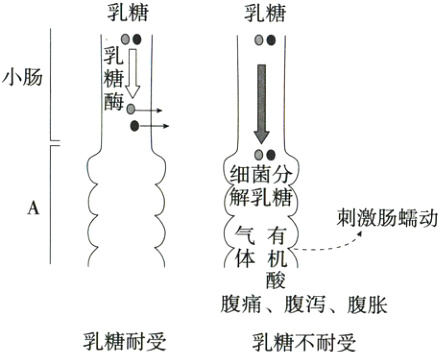 腹痛腹泻腹胀乳糖耐受乳糖不耐受