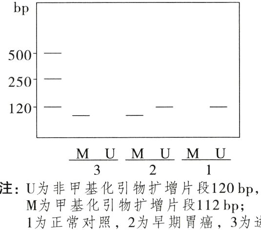 M为甲基化引物扩增片段112bp1为正常对照2为早期胃癌3为进展期胃癌