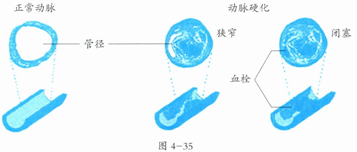 图4-35