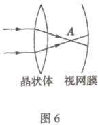 晶状体视网膜图6