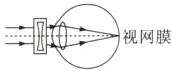 视网膜