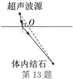 体内结石第13题