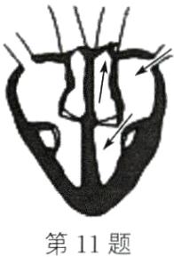 第11题
